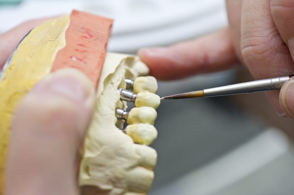 DURODEZ : reportage photo laboratoire dentaire